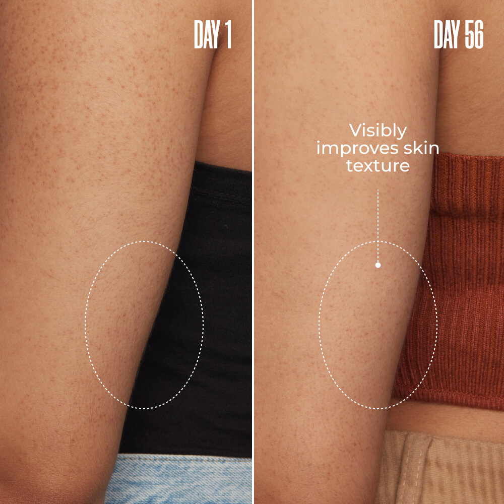 Resurfacing Body Serum product